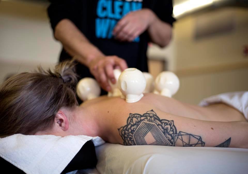 woman lying face down receiving cupping therapy service